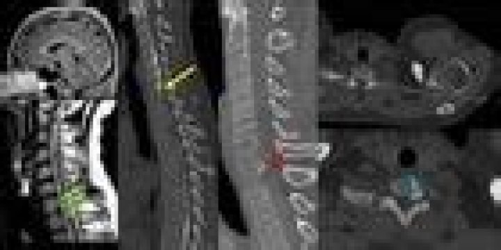 Dr. Ashesh Thaker, MD – Denver, CO