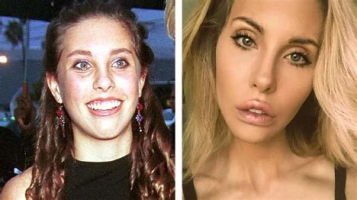 Chloe Lattanzi before and after plastic surgery (Photos)