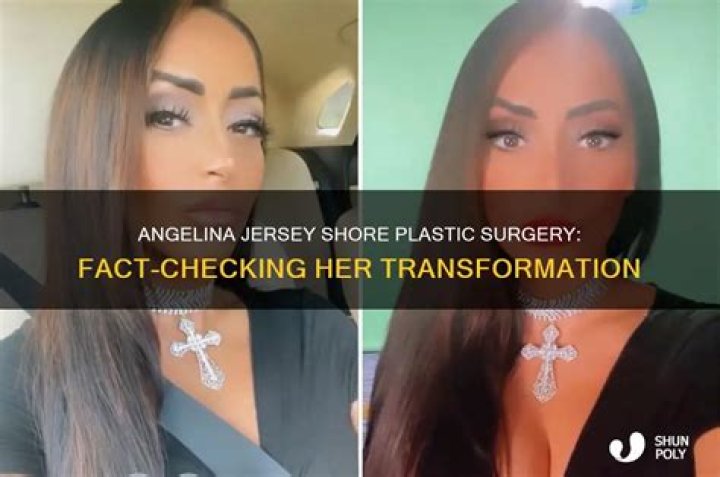 Did Jersey Shore Cast Get Plastic Surgery? – Celebrity
