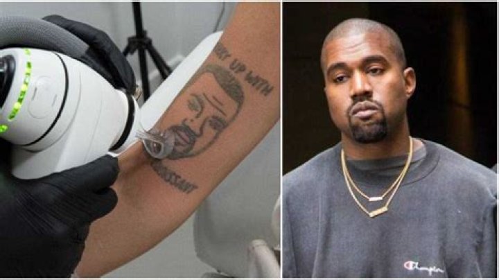 For reasons that should be blindingly obvious a tattoo studio is offering free removal of any Kanye West tattoos