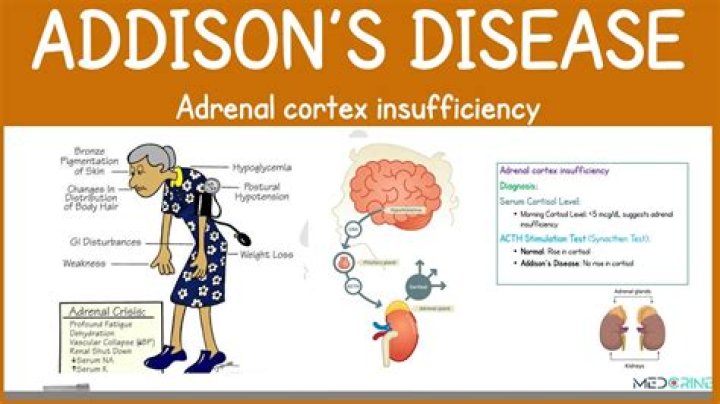 Is Addison’s dad her real dad?