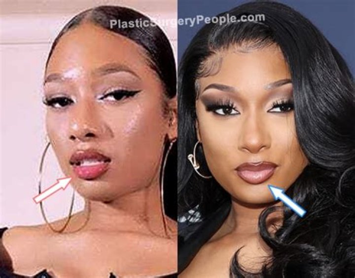 Megan Thee Stallion Plastic Surgery: Exploring Allegations and Transformations