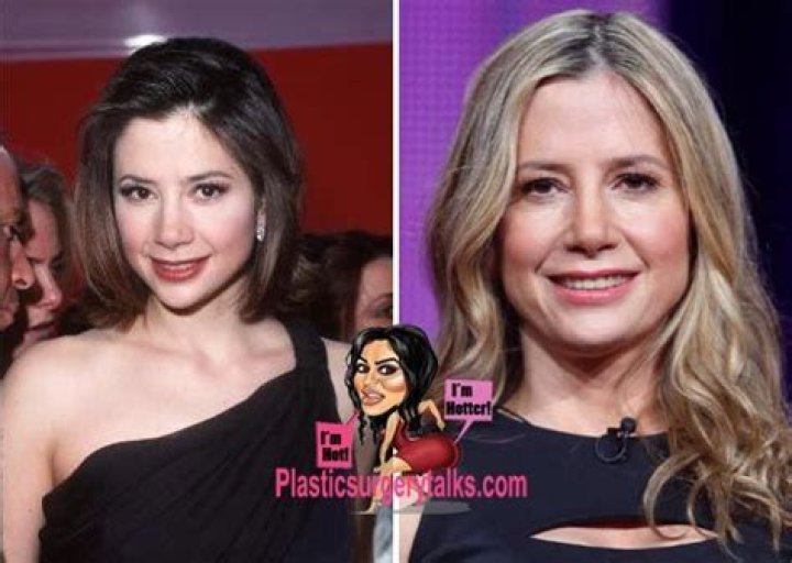 Mira Sorvino Plastic Surgery Before and After