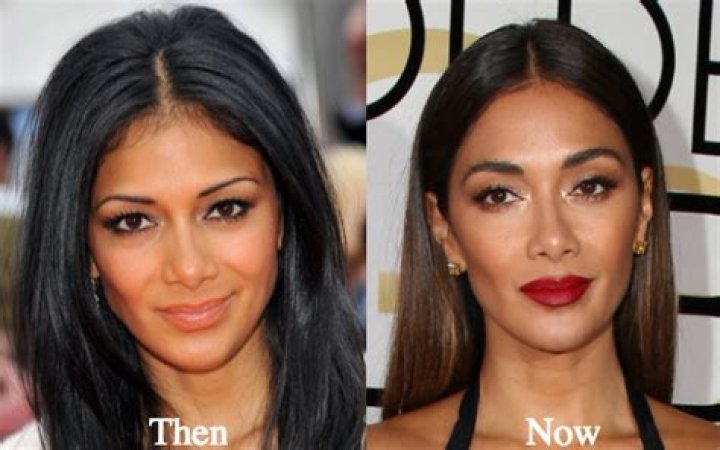 Nicole Scherzinger's Plastic Surgery: A Closer Look