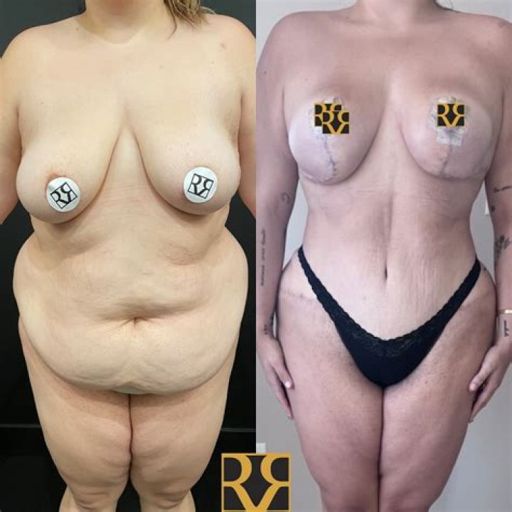 Dr. Remus Repta, MD – Scottsdale, AZ