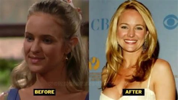 Sharon Case Plastic Surgery: Is It Real or Are Fans Just Making Things Up?