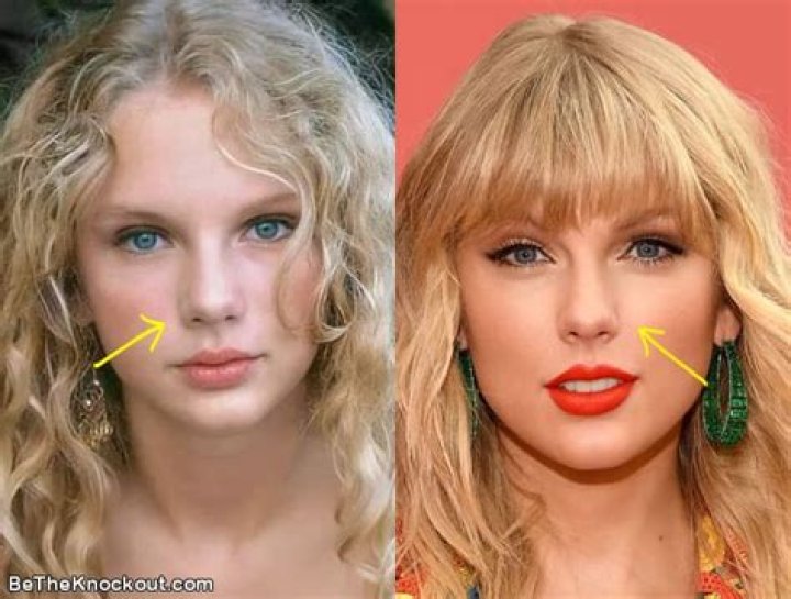 Taylor Swift's Nose Job Dilemma Explored: Rhinoplasty or Rumor?